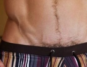épilation du maillot homme