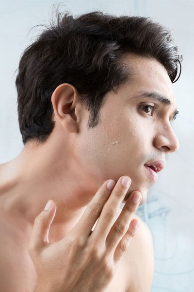 irritation homme