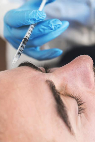 injection de prp contre la perte de cheveux