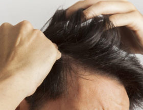 cure de sebum homme