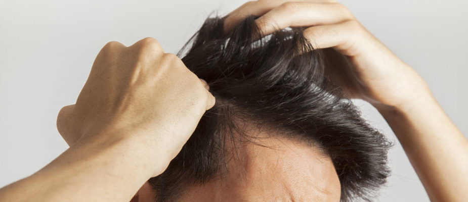 cure de sebum homme