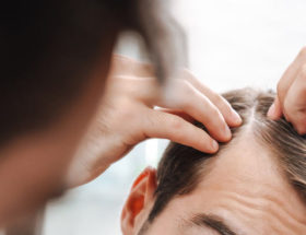 conseils cheveux gras homme