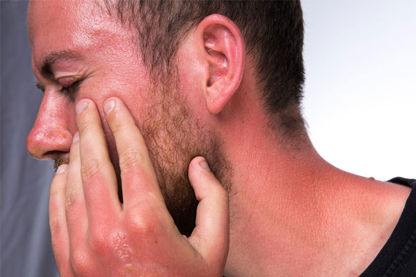 soulager un coup de soleil
