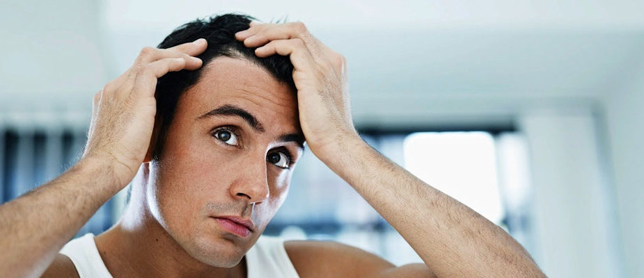 calvitie homme perte de cheveux