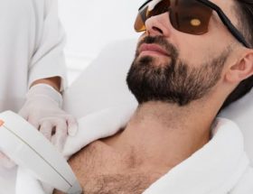 épilation au laser homme