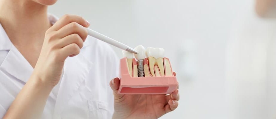 implants dentaires technologies