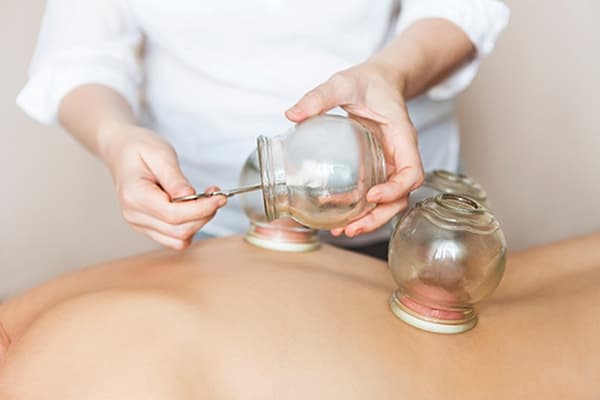 cupping therapy à chaud