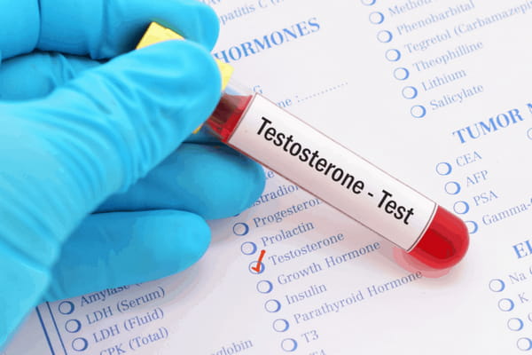 test sanguin taux de testostérone