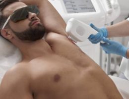 épilation définitive homme