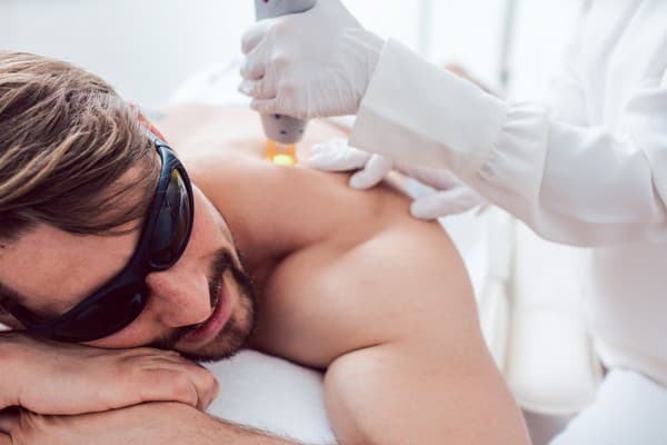 épilation définitive homme