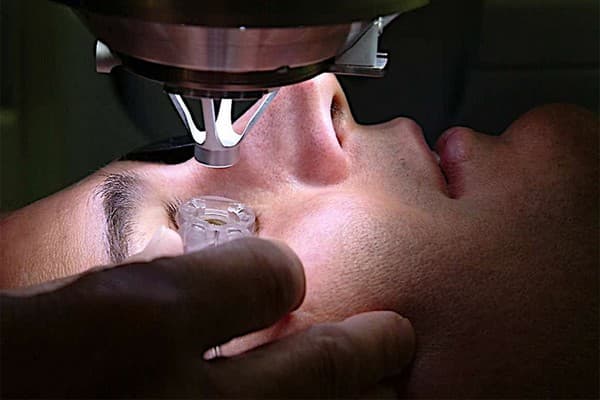 opération des yeux au laser chirurgie réfractive