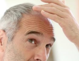 ralentir chute cheveux