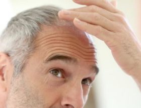 ralentir chute cheveux